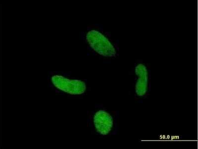 Immunocytochemistry/ Immunofluorescence: Zinc finger protein 287 Antibody [H00057336-B01P]
