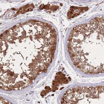 Immunohistochemistry-Paraffin: Zinc finger protein 639 Antibody [NBP2-47571]