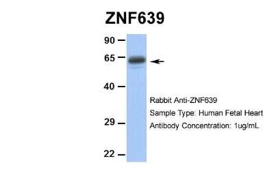 Western Blot: Zinc finger protein 639 Antibody [NBP2-88632]