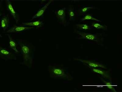 Immunocytochemistry/ Immunofluorescence: Zinc finger protein 668 Antibody [H00079759-B01P]