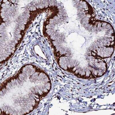 Immunohistochemistry-Paraffin: Zinc finger protein 668 Antibody [NBP1-92615]