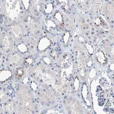 Immunohistochemistry-Paraffin: Zinc finger protein 772 Antibody [NBP1-84113]