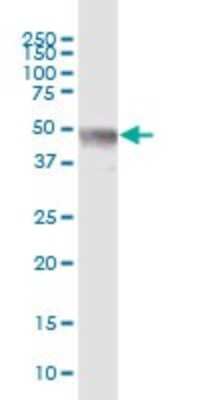 Western Blot: Zinc finger protein 772 Antibody [H00400720-B01P]