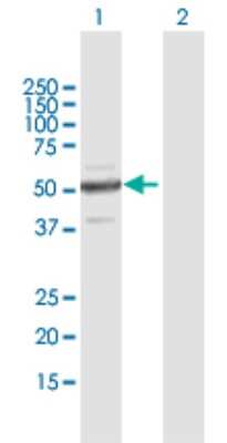 Western Blot: Zinc finger protein 772 Antibody [H00400720-B01P]