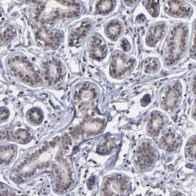 Immunohistochemistry-Paraffin: Zinc finger protein 773 Antibody [NBP1-92616]