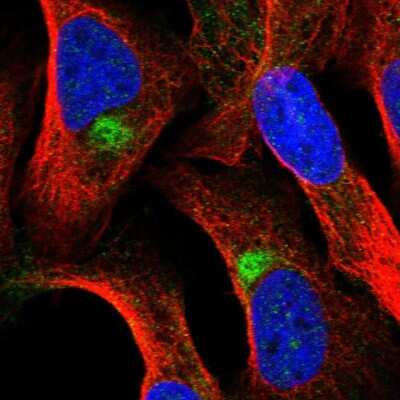 Immunocytochemistry/ Immunofluorescence: Zinc finger protein 774 Antibody [NBP2-55296]