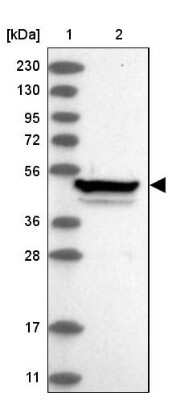Western Blot: Zinc finger protein 774 Antibody [NBP1-92617]