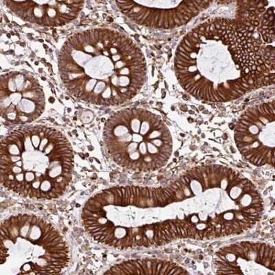 Immunohistochemistry: Zinc finger protein 790 Antibody [NBP2-31625]