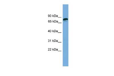 Western Blot: Zinc finger protein 790 Antibody [NBP2-83812]
