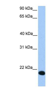 Western Blot: Zinc finger protein 833 Antibody [NBP1-79361]