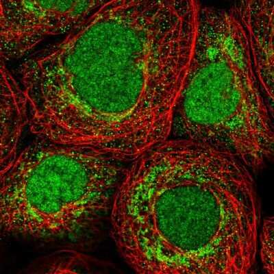 Immunocytochemistry/ Immunofluorescence: Zmat2 Antibody [NBP1-82026]
