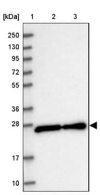 Western Blot: Zmat2 Antibody [NBP1-82026]