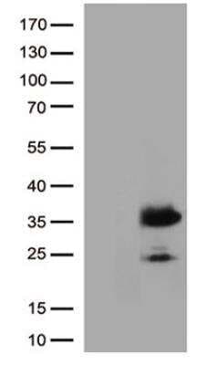 Western Blot: ZsGreen1 Antibody (OTI3C4) [NBP2-78867]