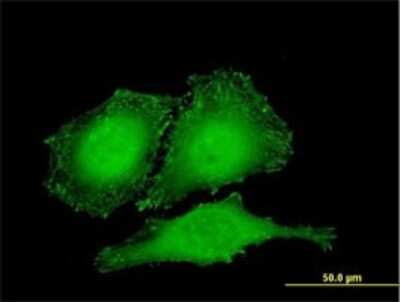 Immunocytochemistry/ Immunofluorescence: Zyxin Antibody (2C10-4A7) [H00007791-M01]