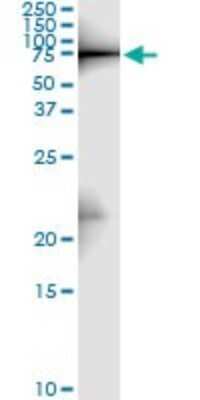 Immunoprecipitation: Zyxin Antibody (2C10-4A7) [H00007791-M01]