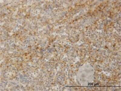 Immunohistochemistry-Paraffin: Zyxin Antibody (2D1) [H00007791-M02]