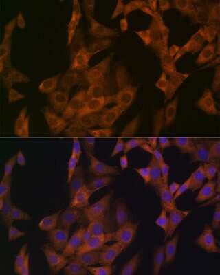 Immunocytochemistry/ Immunofluorescence: Zyxin Antibody (4F9P3) [NBP3-16109]