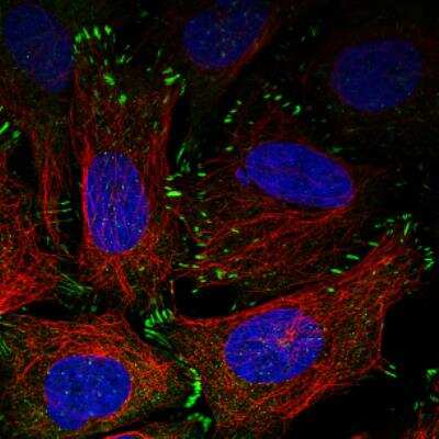 Immunocytochemistry/ Immunofluorescence: Zyxin Antibody (CL2502) [NBP2-36768]
