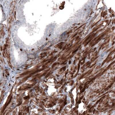 Immunohistochemistry-Paraffin: Zyxin Antibody (CL2502) [NBP2-36768]