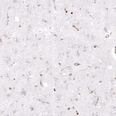 Immunohistochemistry-Paraffin: Zyxin Antibody (CL2502) [NBP2-36768]