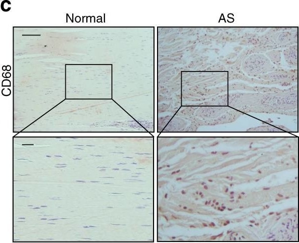 Detection of Human Normal Rabbit IgG Control by Immunohistochemistry