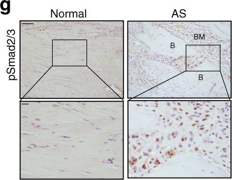 Detection of Human Normal Rabbit IgG Control by Immunohistochemistry
