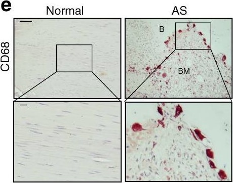 Detection of Human Normal Rabbit IgG Control by Immunohistochemistry