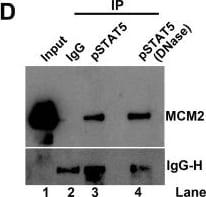 Detection of Human IgG by Western Blot