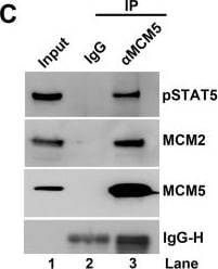 Detection of Human IgG by Western Blot