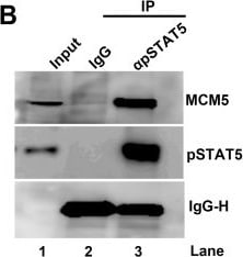 Detection of Human IgG by Western Blot