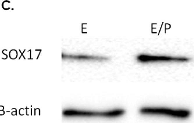 Detection of Human Normal Goat IgG Control by Western Blot