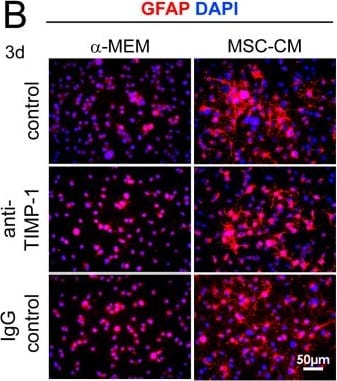 Detection of Rat Normal Goat IgG Control by Immunocytochemistry/ Immunofluorescence