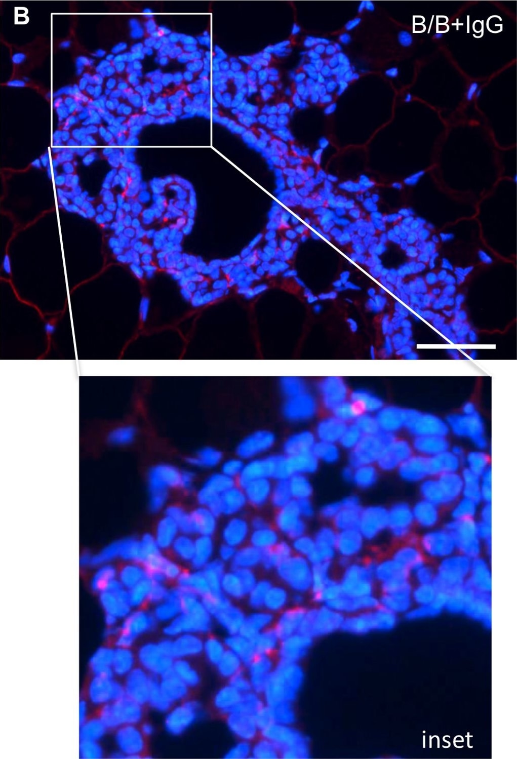 Detection of Mouse IgG by Immunocytochemistry/ Immunofluorescence