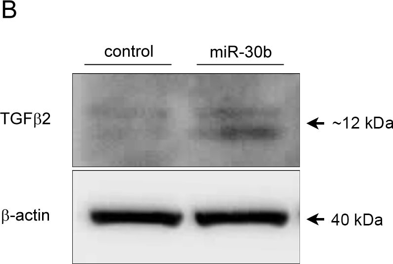 Detection of Human TGF-beta 2 Antibody by Western Blot
