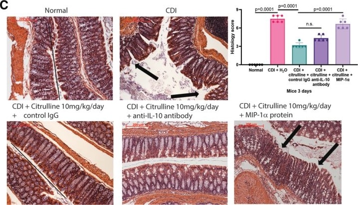 Detection of CCL3/MIP-1 alpha by Immunohistochemistry