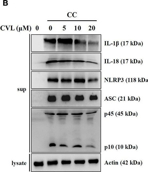 Detection of IL-1 beta /IL-1F2 by Western Blot
