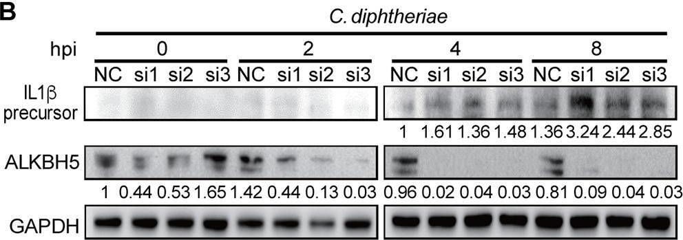 Detection of IL-1 beta /IL-1F2 by Western Blot