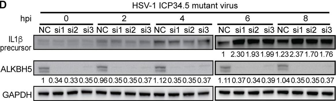 Detection of IL-1 beta /IL-1F2 by Western Blot