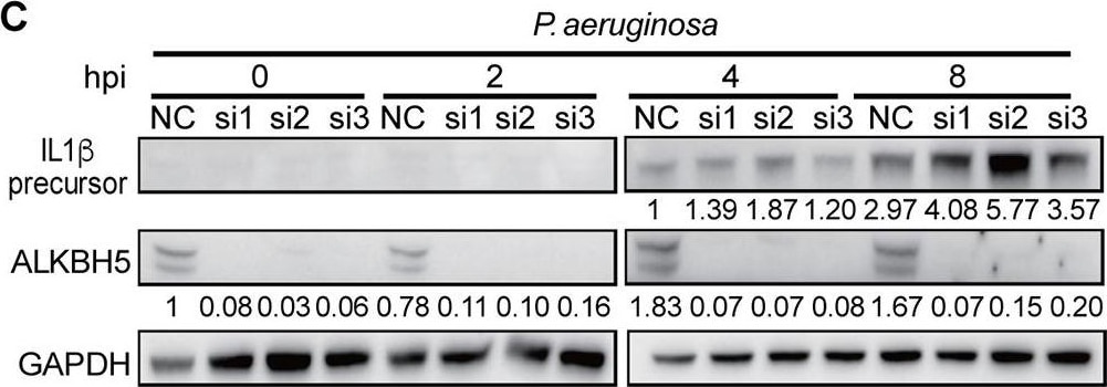Detection of IL-1 beta /IL-1F2 by Western Blot