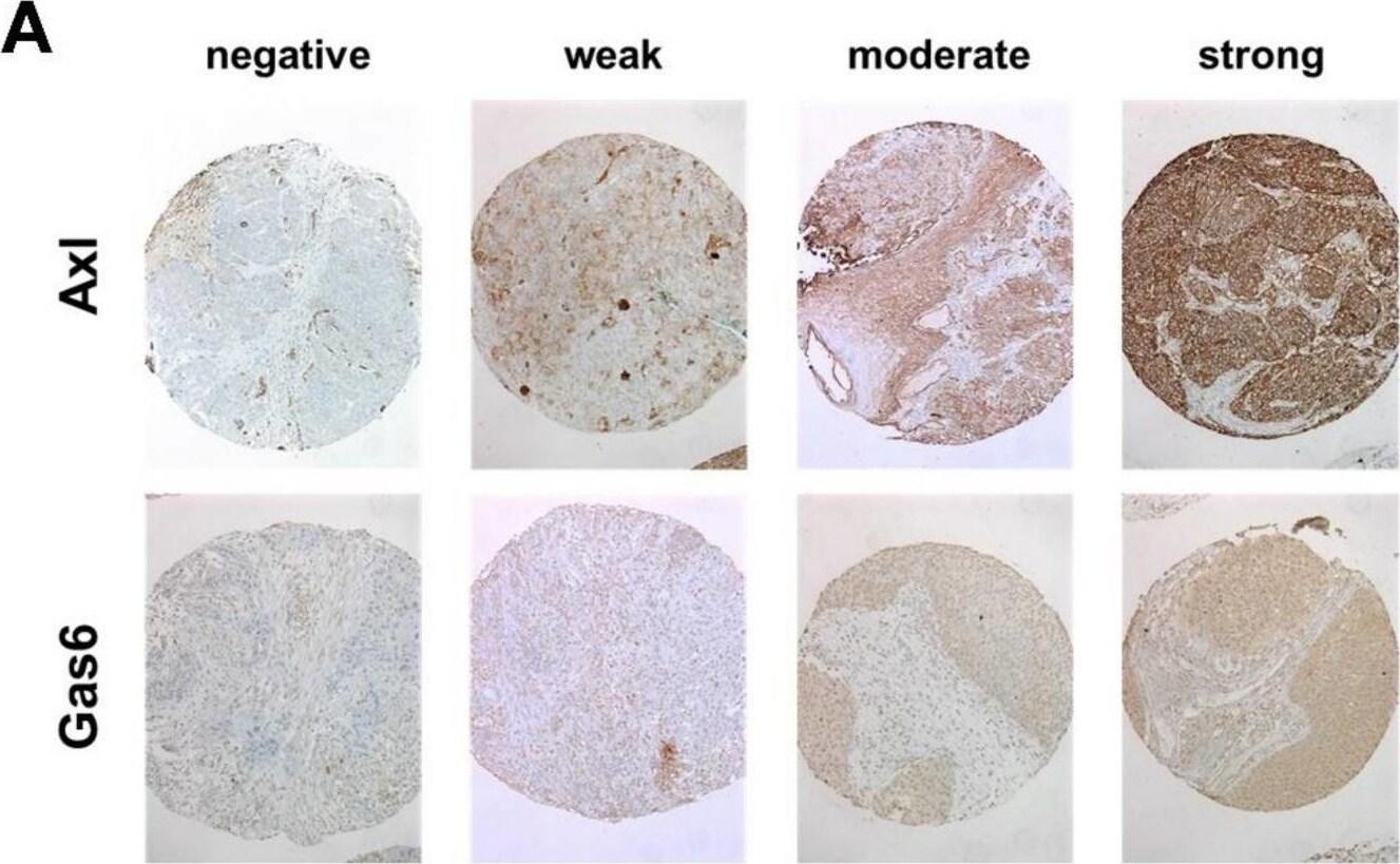 Detection of Gas6 by Immunohistochemistry