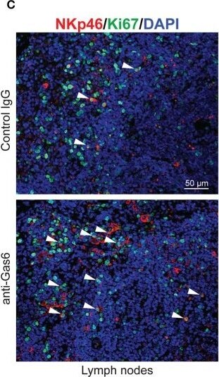 Detection of Gas6 by Immunohistochemistry