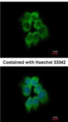 Immunocytochemistry/ Immunofluorescence: actin-related protein 2/3 complex subunit 1B Antibody [NBP2-15262]