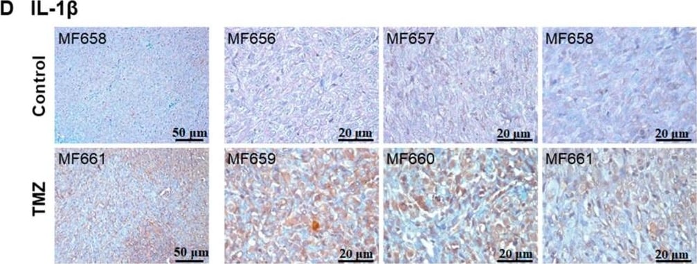 Detection of Human IL-1 beta/IL-1F2 by Immunohistochemistry