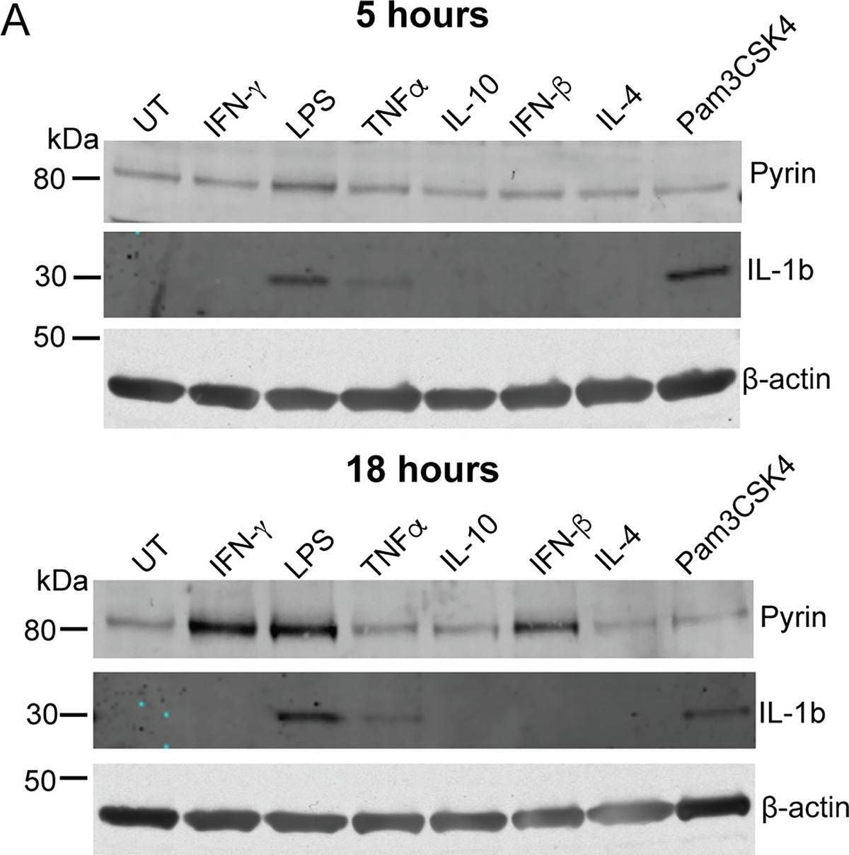Detection of IL-1 beta /IL-1F2 by Western Blot