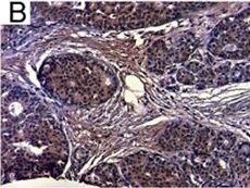 Detection of Human IL-6 by Immunohistochemistry