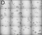Detection of Human IL-6 by Block/Neutralize