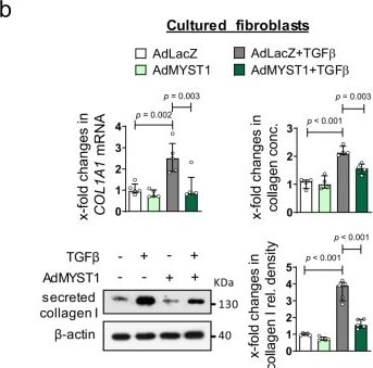Detection of LAP (TGF-beta 1) by Western Blot