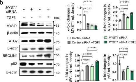 Detection of LAP (TGF-beta 1) by Western Blot