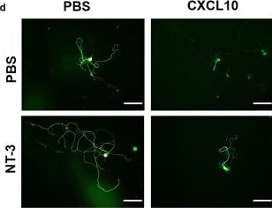 Detection of NT-3 by Immunocytochemistry/ Immunofluorescence