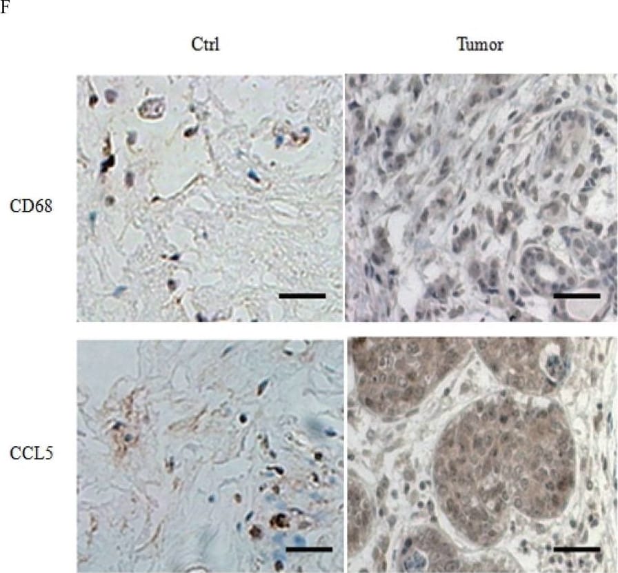 Detection of Human Human CCL5/RANTES Antibody by Immunohistochemistry